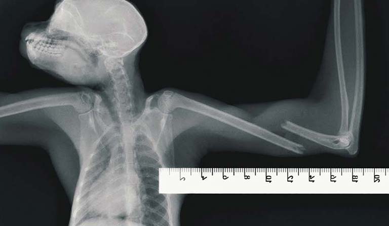 X-ray of a bird's upper body and wings with a ruler for scale.